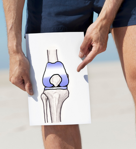 Pooperační péče po operaci (TEP) kolene
